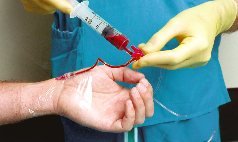 Simplified Arterial Blood Gases Simplified Nursing